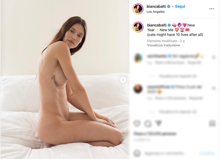 Bianca Balti mostra le cicatrici. - Instagram