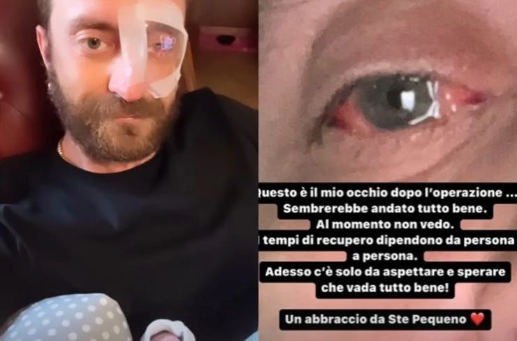 Stefano Corti - Come sta dopo l'operazione.