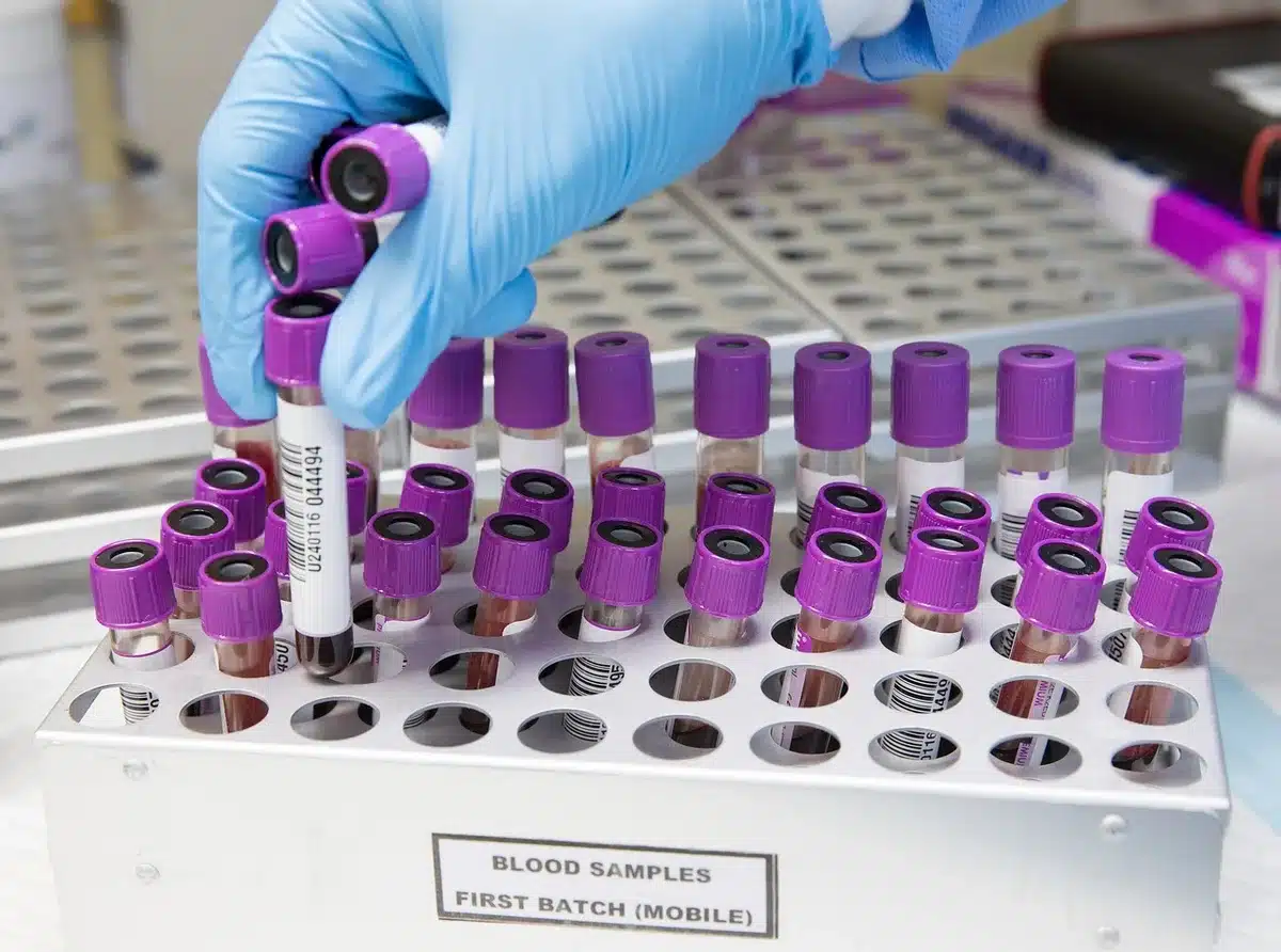 Ricerca sull'IA in ambito sanitario con strumenti di laboratorio